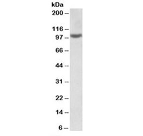 Western blot testing of HeLa lysate with ICAM1 antibody at 2ug/ml. Predicted molecular weight: ~58/75-115kDa (unmodified/glycosylated).