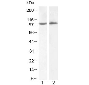 Western blot testing of human 1) HeLa and 2) Daudi lysate with ICAM1 antibody at 2ug/ml. Predicted molecular weight: ~58/75-115 kDa (unmodified/glycosylated).