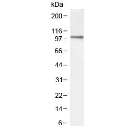 Western blot testing of mouse NIH3T3 lysate with ICAM1 antibody at 2ug/ml. Predicted molecular weight: ~58/75-115 kDa (unmodified/glycosylated).