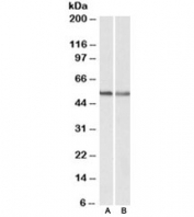 Western blot testing of human A549 [A] and mouse NIH3T3 [B] lysates with CB1 antibody at 0.3ug/ml. Predicted molecular weight ~53kDa, can also be observed at ~70kDa.