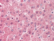 IHC testing of FFPE human liver tissue with ALDH6A1 antibody at 5ug/ml. Required HIER: steamed antigen retrieval with pH6 citrate buffer; AP-staining.