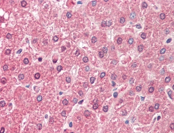 IHC testing of FFPE human liver tissue with ALDH6A1 antibody at 5ug/ml. Required HIER: steamed antigen retrieval with p