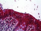 IHC testing of FFPE human colon tissue with LRP4 antibody at 3.75ug/ml. Required HIER: steamed antigen retrieval with pH6 citrate buffer; AP-staining.