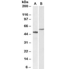 Western blot testing of human hippocampus [A] and HeLa [B] lysates with CD47 antibody at 0.3ug/ml. Predicted molecular weight: 35~60kDa depending on glycosylation level.