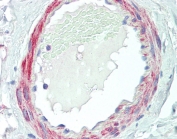 IHC testing of FFPE human small intestine tissue with VPS35 antibody at 5ug/ml. Required HIER: steamed antigen retrieval with pH6 citrate buffer; AP-staining.