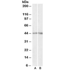 Western blot testing of human [A] and mouse [B] kidney lysates with Podocin antibody at 0.3ug/ml. Predicted molecular weight ~42kDa.~