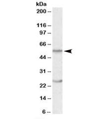 Western blot testing of human thymus lysate with OCT2 antibody at 0.5ug/ml. Predicted molecular weight: isoforms 1-5 range in size from 43~62kDa. Both observed bands are blocked by addition of immunizing peptide.