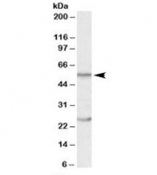 Western blot testing of human thymus lysate with OCT2 antibody at 0.5ug/ml. Predicted molecular weight: isoforms 1-5 range in size from 43~62kDa. Both observed bands are blocked by addition of immunizing peptide.