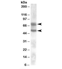 Western blot testing of human kidney lysate with DACH1 antibody at 0.1ug/ml. Predicted molecular weight: ~73/57/52kDa (isoforms a/b/c).
