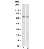 Western blot of mouse (A) and rat (B) brain with STK39 antibody at 1ug/ml. Predicted molecular weight: ~60kDa.