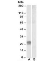 Western blot testing of human pancreas lysate with HMGA1 antibody at 0.5ug/ml with [B] and without [A] immunizing peptide. Predicted molecular weight: ~12/11/20kDa (isoforms 1a/1b/1c or HMG-I/-Y/-R).