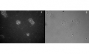 Immunocytochemistry staining of CD25-sorted (Treg) human blood cells with FOXP3 antibody, detected by FITC (A) and in phase contrast (B).