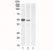 Western blot testing of 1) human muscle, 2) MOLT4 and 3) human pancreas (negative control) lysate at 1/2/1 ug/ml respectively. Predicted molecular weight ~47 kDa.