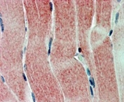 IHC staining of FFPE human skeletal muscle with SIRT4 antibody at 2ug/ml. HIER: steamed with pH6 citrate buffer, AP-staining.
