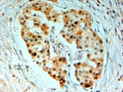 IHC staining of FFPE human pancreas with SIRT4 antibody at 2ug/ml. HIER: steamed with pH6 citrate buffer, AP-staining.