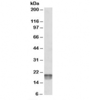 Western blot testing of human heart lysate with NDUFS7 antibody at 0.1ug/ml. Predicted molecular weight: ~24kDa but routinely observed at ~20kDa.