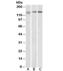 Western blot of mouse spleen (A), mouse thymus (B) and rat spleen (C) lysates with STAG2 antibody at 0.3ug/ml. Predicte