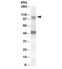 Western blot testing of human ovay lysate with LIP1 antibody at 0.5ug/ml. The expected ~110kDa band and the additional ~48kDa band are both blocked by the immunizing peptide.