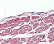 IHC staining of FFPE human heart with SLC12A6 antibody at 2.5ug/ml. HIER: steamed with pH6 citrate buffer, AP-staining.