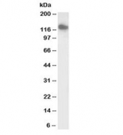 Western blot testing of human heart lysate with biotinylated SLC12A6 antibody at 0.1ug/ml. Predicted molecular weight: ~120~126kDa (isoforms 1-6).