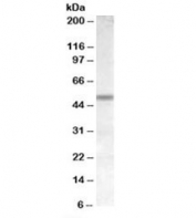 Western blot testing of human cerebellum lysate with CHRNB3 antibody at 1ug/ml. Predicted molecular weight: ~53kDa.
