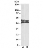 Western blot testing of human tonsil [A] and thymus [B] lysates with FCRL1 antibody at 0.5ug/ml. Predicted molecular weight: ~47/55kDa (unmodified/glycosylated).