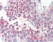 IHC testing of FFPE human testis tissue with MARCH10 antibody at 5ug/ml. Required HIER: steamed antigen retrieval with pH6 citrate buffer; AP-staining.