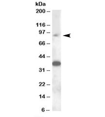 Western blot testing of rat testis lysate with MARCH10 antibody at 0.3ug/ml. Predicted/observed molecular weight: ~90kDa. Both observed bands are blocked by addition of immunizing peptide.~