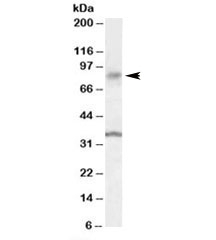 Western blot testing of human substantia nigra lysate with ANKK1 antibody at 0.1ug/ml. Predicted/observed molecular weight: ~85kDa. Both observed bands are blocked by addition of immunizing peptide.~