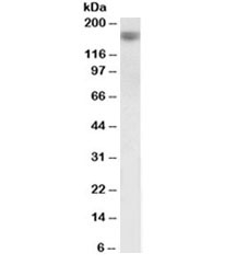 Western blot testing of human prostate lysate with EGF antibody at 1ug/ml. Predicted band size : 134 kDa but routinely observed at 160kDa.