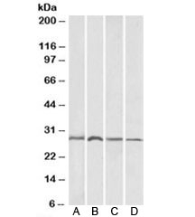 Western blot of A) mouse brain, B) rat brain, C) mouse liver and D) rat liver lysates with SIAH1 antibody at 1ug/ml. Predict