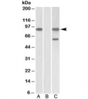 Western blot of HEK293 lysate overexpressing human NUMBL-MYC probed with NUMBL antibody [1ug/ml] in Lane A and probed with anti-MYC [1/1000] in Lane C. Mock-transfected HEK293 probed with NUMBL antibody [1ug/ml] in Lane B. Observed molecular weight ~85kDa.