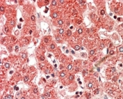 IHC staining of FFPE human liver with ALDH6A1 antibody at 5ug/ml. HIER: steamed with pH6 citrate buffer, AP-staining.