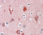 IHC staining of FFPE human cortex with MUNC18-1 antibody at 5ug/ml. HIER: steamed with pH6 citrate buffer, AP-staining.