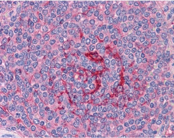 IHC testing of FFPE human spleen tissue with GABPB2 antibody at 3.75ug/ml. Required HIER: steamed antigen retrieval with pH6 citrate buffer; AP-staining.