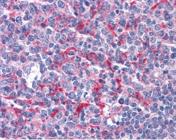 IHC testing of FFPE human tonsil tissue with GABPB2 antibody at 3.75ug/ml. Required HIER: steamed antigen retrieval with pH6 citrate buffer; AP-staining.