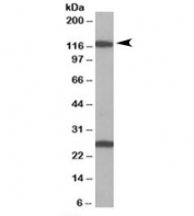 Western blot testing of Daudi lysate with Importin 7 antibody at 1ug/ml. The expected ~120 kDa band and the additional ~26kDa band are both blocked by the immunizing peptide.