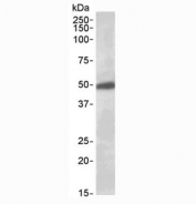 Western blot testing of human brain (substantia nigra) lysate with GIRK2 antibody at 0.5ug/ml. Predicted molecular weight ~48 kDa.