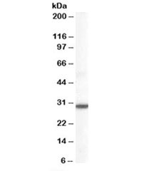 Western blot testing of human lung lysate with DDAH2 antibody at 0.1ug/ml. Predicted molecular weight: ~29kDa.