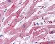 IHC testing of FFPE human heart tissue with BAG3 antibody at 3.75ug/ml. Required HIER: steamed antigen retrieval with pH6 citrate buffer; AP-staining.