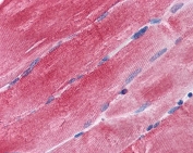 IHC testing of FFPE human skeletal muscle tissue with BAG3 antibody at 3.75ug/ml. Required HIER: steamed antigen retrieval with pH6 citrate buffer; AP-staining.