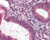 IHC staining of FFPE human uterus with NR1H2 antibody at 3ug/ml. HIER: steamed with pH6 citrate buffer, AP-staining.