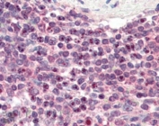 IHC staining of FFPE human spleen with NR1H2 antibody at 3ug/ml. HIER: steamed with pH6 citrate buffer, AP-staining.