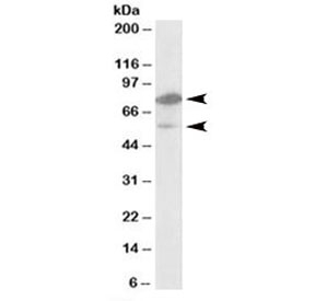 Western blot testing of human bone marrow lysate with NR1H2 antibody at 1ug/ml. Predicted molecular weight: ~51kDa. The ~60/80kDa observed band size is likely due to acetylation.
