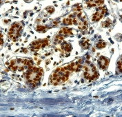 IHC testing of FFPE human breast with TRIM28 antibody at 2ug/ml. HIER: steamed with pH9 citrate buffer, HRP-staining.