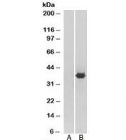 Western blot of HEK293 lysate overexpressing MORF4L2 probed with MORF4L2 antibody (mock transfection in lane 1). Predicted molecular weight: ~32kDa.