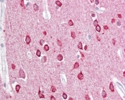 IHC testing of FFPE human brain (cortex) tissue with PACSIN1 antibody at 2.5ug/ml. Required HIER: steamed antigen retrieval with pH6 citrate buffer; AP-staining.
