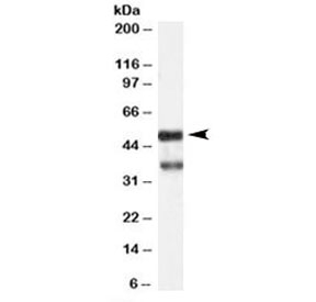 Western blot testing of human hippocampus lysate with PACSIN1 antibody at 1ug/ml. Predicted/observed molecular weight: ~50kDa. Both observed bands are blocked by addition of immunizing peptide.
