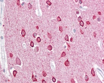 IHC testing of FFPE human brain (cortex) tissue with PACSIN1 antibody at 2.5ug/ml. Required HIER: steamed antigen retrieval with pH6 citrate buffer; AP-staining.