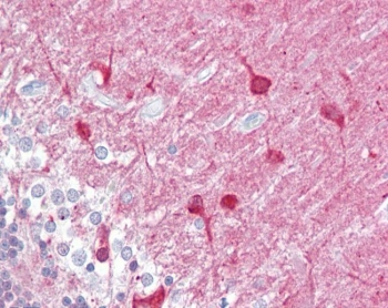 IHC testing of FFPE human brain (cerebellum) tissue with PACSIN1 antibody at 2.5ug/ml. Required HIER: steamed antigen retrieval with pH6 citrate buffer; AP-staining.